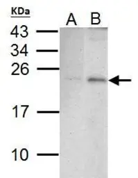 Anti-PUMA antibody [C2C3], C-term used in Western Blot (WB). GTX109675